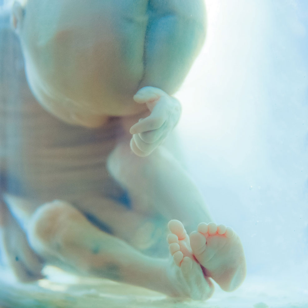 fetus